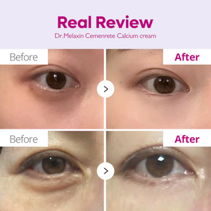 Dr.Melaxin Cemenrete Calcium Intense Cream (50ml)