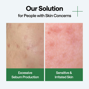 MEDIHEAL Teatree Wrapping Serum Mask Calming Hydra (1 sheet)