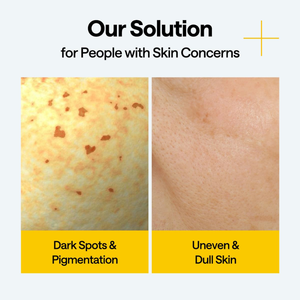 MEDIHEAL Vitamin C Wrapping Serum Mask Brightening (1 sheet)