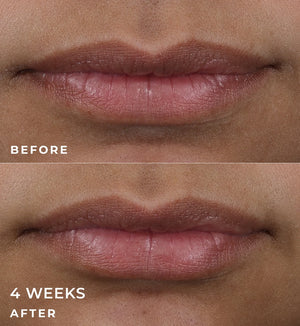 ROC Derm Correxion Lip Volumizer 10ml